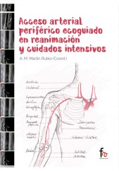 ACCESO ARTERIAL PERIFÉRICO ECOGUIADO EN  REANIMACIÓN Y CUIDADOS INTENSIVOS